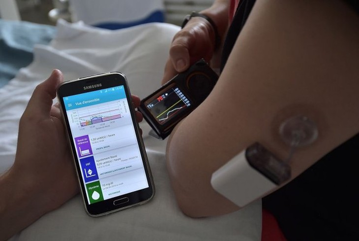 Dùng smart-phone hỗ trợ tuỵ nhân tạo điều trị bệnh tiểu đường tuýp 1 - Ảnh 1.