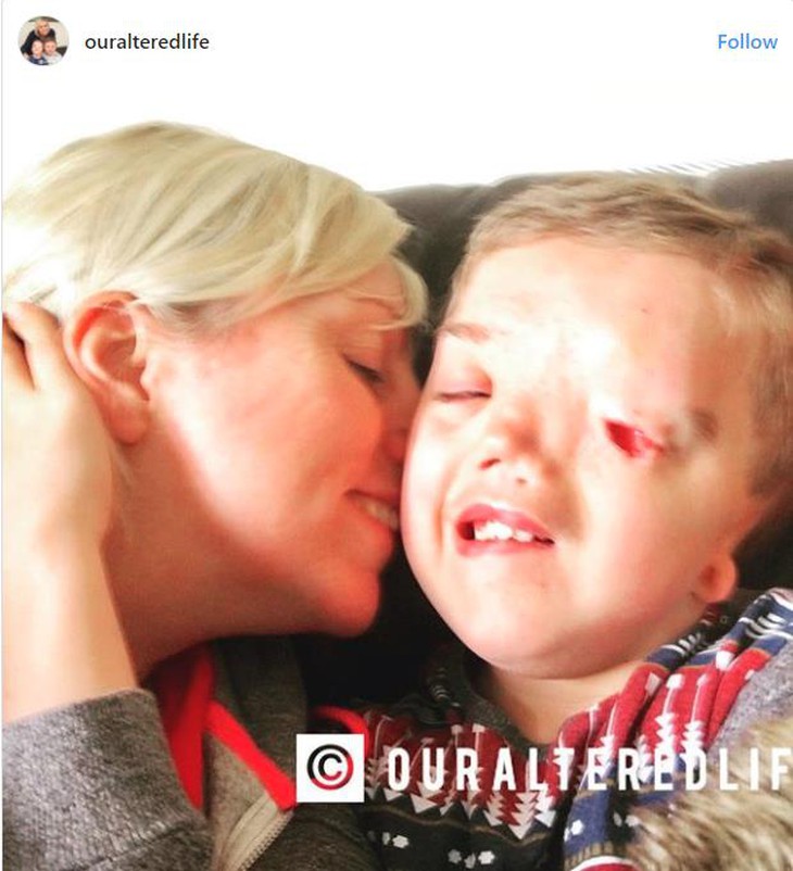 Instagram xin lỗi vì xóa ảnh cậu bé có khuôn mặt biến dạng - Ảnh 1.